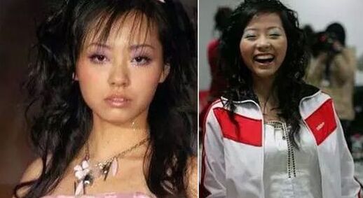 張靚穎整容了嗎 張靚穎整容前后照片對(duì)比