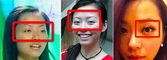 張靚穎整容了嗎 張靚穎整容前后照片對(duì)比