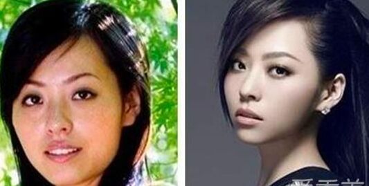 張靚穎整容了嗎 張靚穎整容前后照片對(duì)比