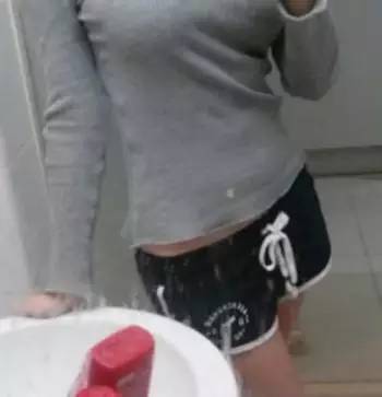 北京炫美腹部吸脂術(shù)后 穿衣服更有型了！