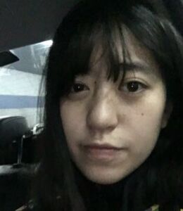 激光點痣不留坑不留疤，果棒棒噠