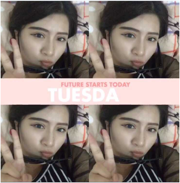 廣州麗尚做的全切開雙眼 變身混血兒