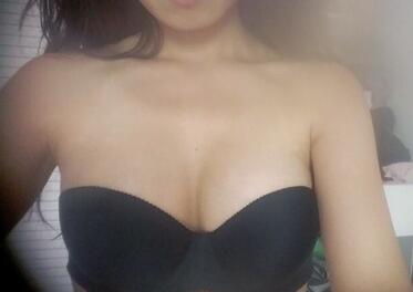 成都艾米麗自體脂肪豐胸前后對比
