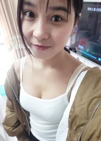 成都艾米麗自體脂肪豐胸前后對比