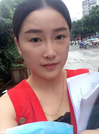 愛悅麗格玻尿酸豐蘋果肌、豐下巴、隆鼻