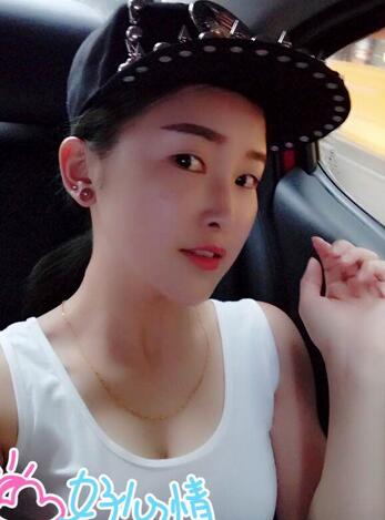 愛悅麗格玻尿酸豐蘋果肌、豐下巴、隆鼻