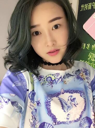 愛悅麗格玻尿酸豐蘋果肌、豐下巴、隆鼻