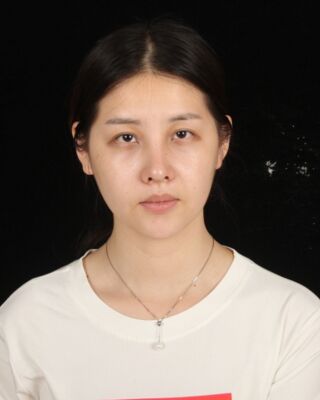全切雙眼皮+開眼角前后對比照片圖