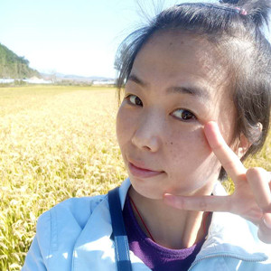 激光祛曬斑真實案例分享，并附上前后對比圖片