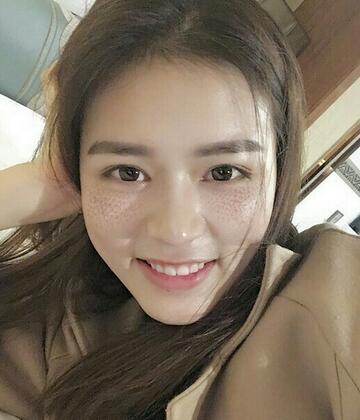 廣州凱美達皮膚美容激光祛斑前后對比