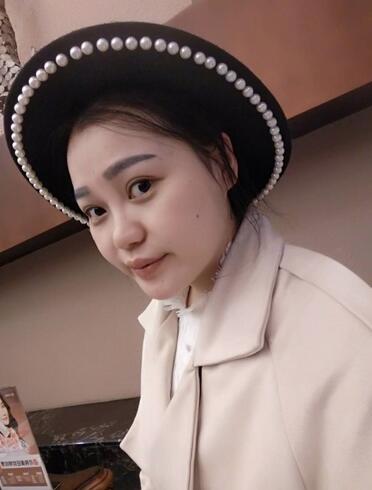 上海九院李圣利隆鼻整形真實恢復期圖片