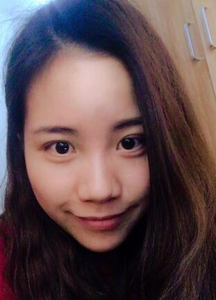 北京藝星王英勇隆鼻案例 隆鼻整形三個月