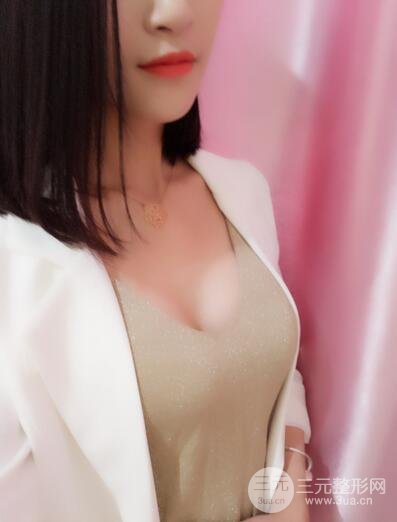 曼托假體+自體脂肪豐胸前后對比 重慶軍美打造果凍胸
