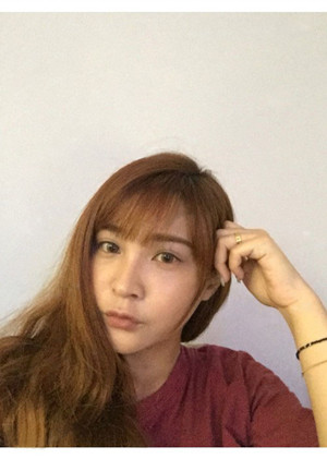 高強度聚焦超聲手術(shù)前后過程以及真實案例分享——廈門思明安黛美林韻醫(yī)生做的