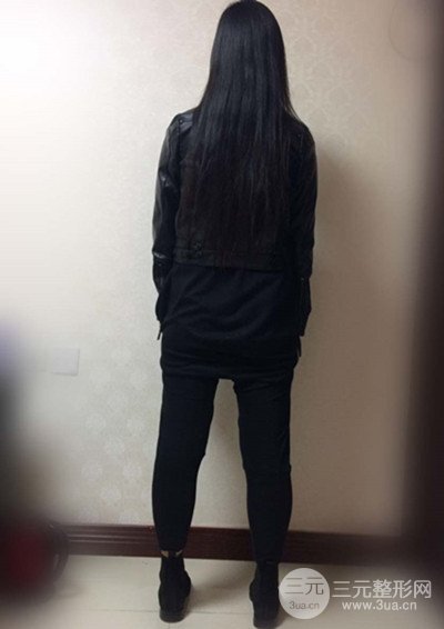 大腿抽脂真實(shí)過程圖,輕松擁有細(xì)長雙腿