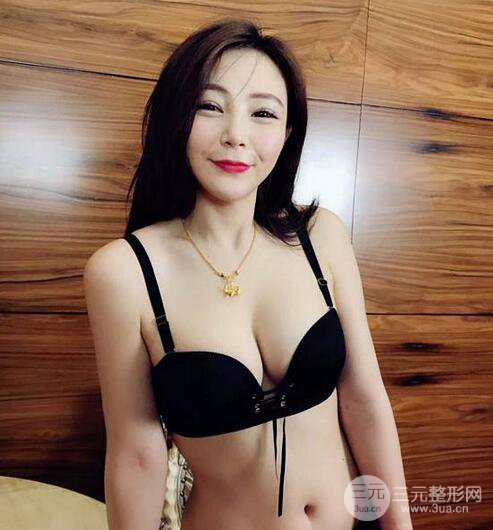 自體脂肪豐胸3個(gè)月分享,活細(xì)胞豐胸術(shù)后果逼真更自然