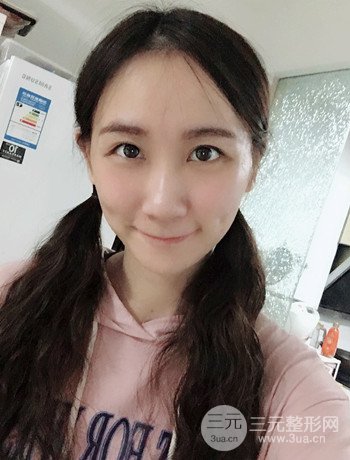 面部埋埋蛋白線.提升改良皮膚松弛,立現(xiàn)小V臉
