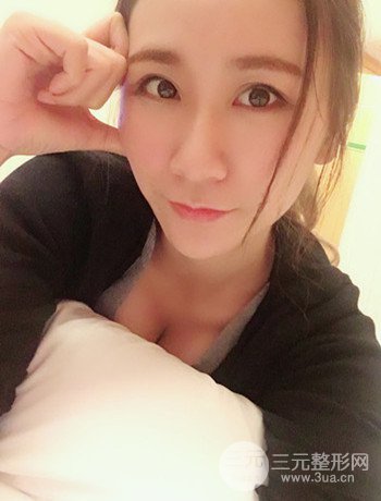 面部埋埋蛋白線.提升改良皮膚松弛,立現(xiàn)小V臉