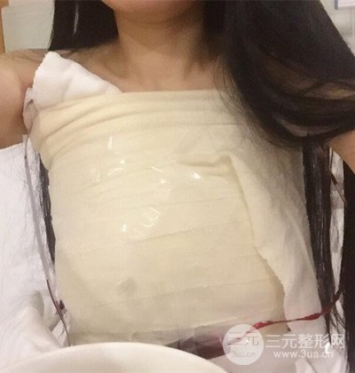 假體隆胸手術(shù)恢復(fù)記錄,豐滿大胸不是夢