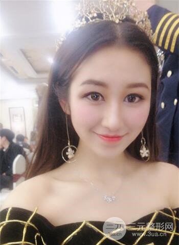 廣州隆鼻整形真實(shí)恢復(fù)期圖片,擁有精致美鼻不是夢(mèng)