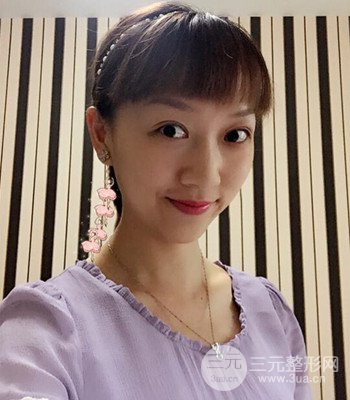 北京雙眼皮失敗修復手術日記分享,附上前后對比照片