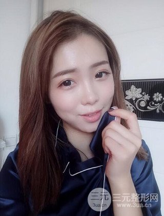 在上海諾詩(shī)做了自體脂肪填充全臉真人案例大曝光