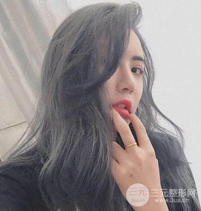 隆鼻整形+埋埋蛋白線.提升+自體脂肪全臉填充術(shù)后改頭換面！