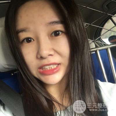 做了牙齒冷光美白果很棒，綻放美麗笑容