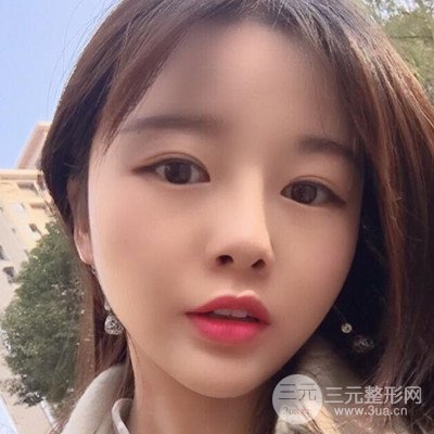 做了牙齒冷光美白果很棒，綻放美麗笑容