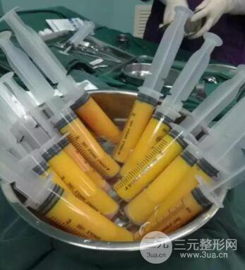 自體脂肪去眉間紋術(shù)后護(hù)理工作主要有些什么？
