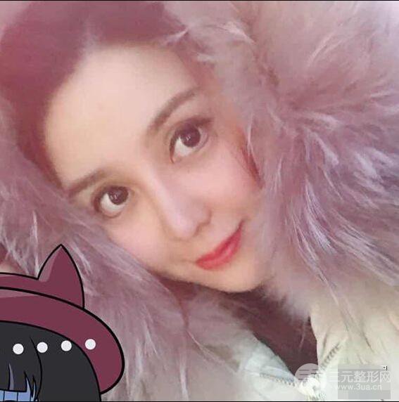 昆明吳氏嘉美李明硅膠隆鼻前后對比圖恢復(fù)心情小札