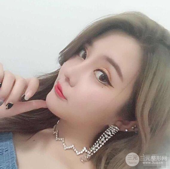 昆明吳氏嘉美李明硅膠隆鼻前后對比圖恢復(fù)心情小札