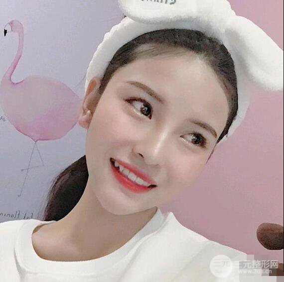 成都華西醫(yī)院整形美容科卿勇隆鼻整形前后對比圖恢復(fù)心情小札