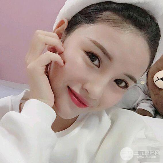 成都華西醫(yī)院整形美容科卿勇隆鼻整形前后對比圖恢復(fù)心情小札