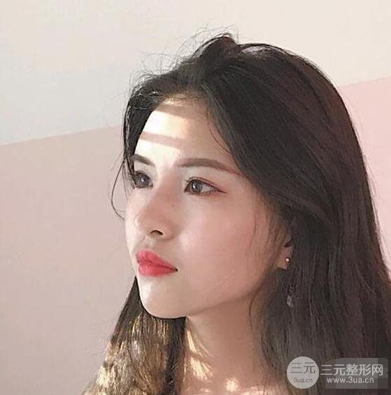 成都華西醫(yī)院整形美容科卿勇隆鼻整形前后對比圖恢復(fù)心情小札