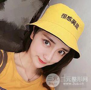 杭州格萊美張樹功假體隆鼻前后對比圖|內附恢復心情變化哦