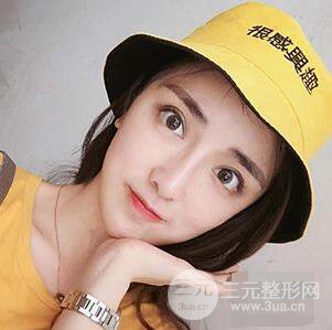 杭州格萊美張樹功假體隆鼻前后對比圖|內附恢復心情變化哦