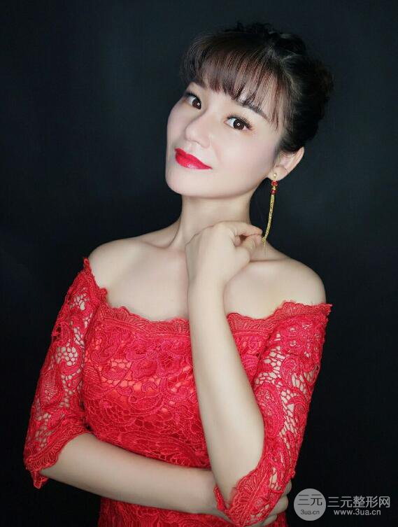 廈門修志夫隆鼻整形前后對(duì)比圖真人案例恢復(fù)小札
