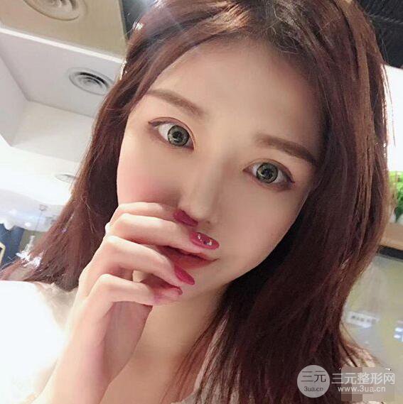延吉金光善眼部整形失敗修復前后對比圖 三個月恢復自然