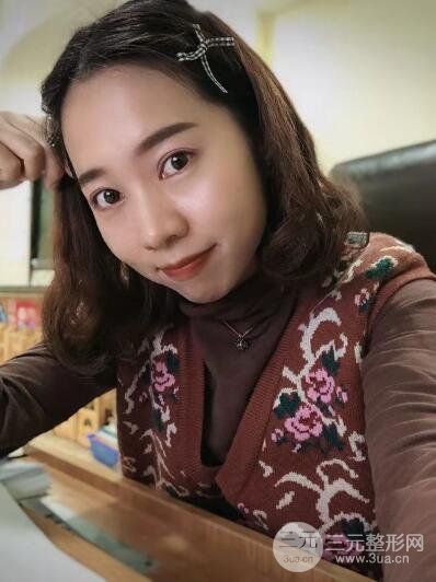 湘潭華美切開雙眼皮案例對(duì)照?qǐng)D兩個(gè)月恢復(fù)過(guò)程心情日扎