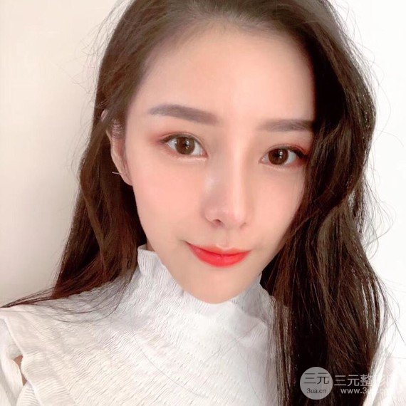 【隆鼻整形+進(jìn)口假體+耳軟骨墊鼻尖+鼻頭鼻翼縮小+鼻尖延長(zhǎng)】綜合改良！
