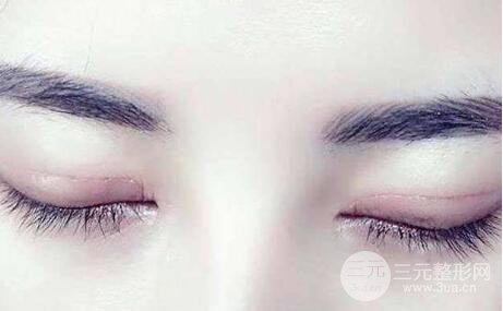 埋線雙眼皮好嗎?眼皮會(huì)留疤嗎?