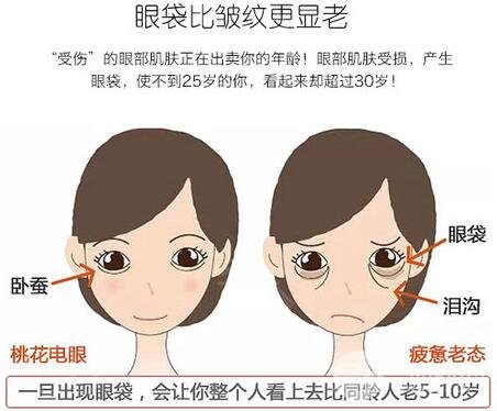 激光去眼袋多少錢？貴嗎？別讓你的眼袋越變越大！