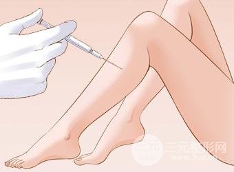 瘦腿價格貴不貴？一般多少錢？