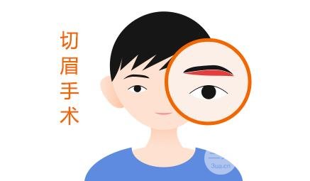 切眉術(shù)會留下疤痕嗎?