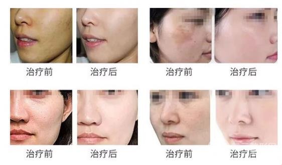 術(shù)者自身?xiàng)l件不同