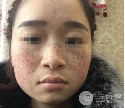 黑臉娃娃美容成好嗎