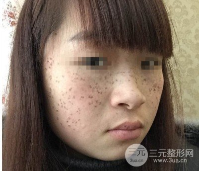 黑臉娃娃美容成好嗎