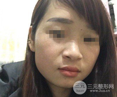 黑臉娃娃美容成好嗎