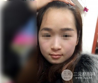 黑臉娃娃美容成好嗎